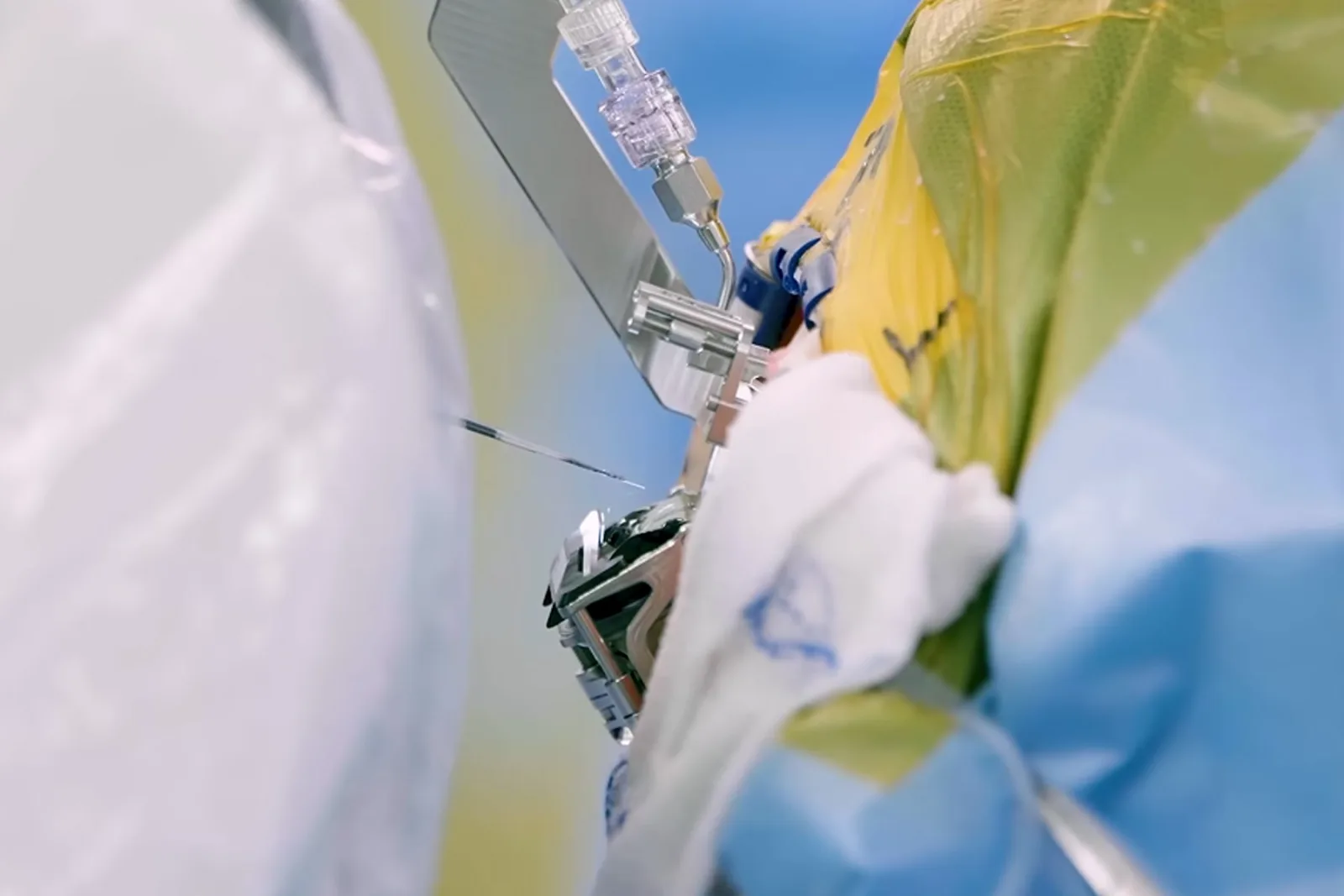 Neuralink Advances Brain Implant Surgery with Less Invasive Transdural Technique